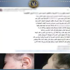 مدرسة تضرب طفلة بالإسكندرية وتقر بالواقعة