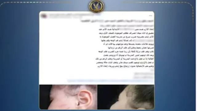 مدرسة تضرب طفلة بالإسكندرية وتقر بالواقعة