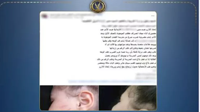 مدرسة تضرب طفلة بالإسكندرية وتقر بالواقعة